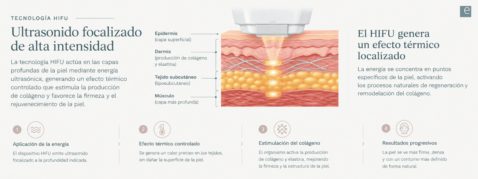 HIFU - Ultrasonido focalizado de alta intensiad